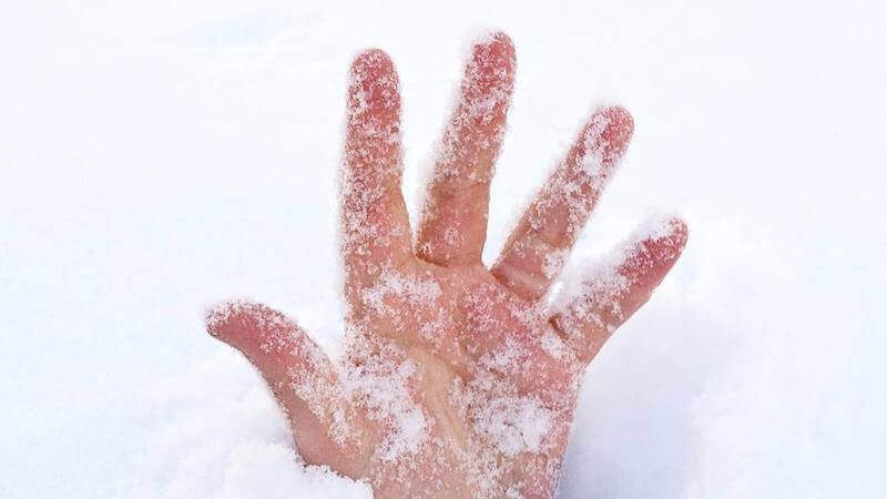 Frostbite Treatment