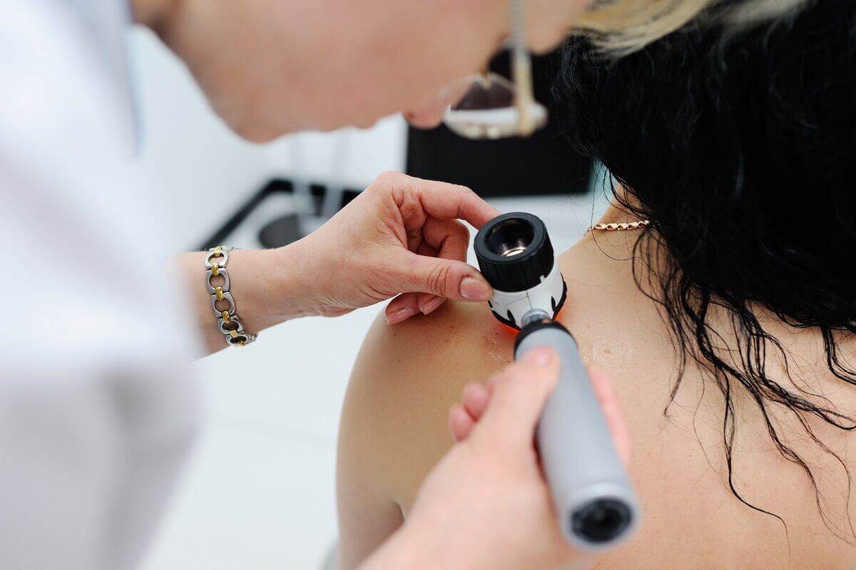 Don’t Risk It: Know the Signs of Skin Cancer